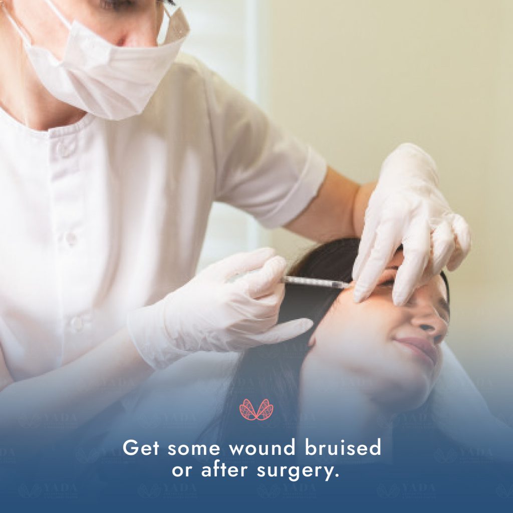 Hyperbaric Oxygen Yada Pattaya5