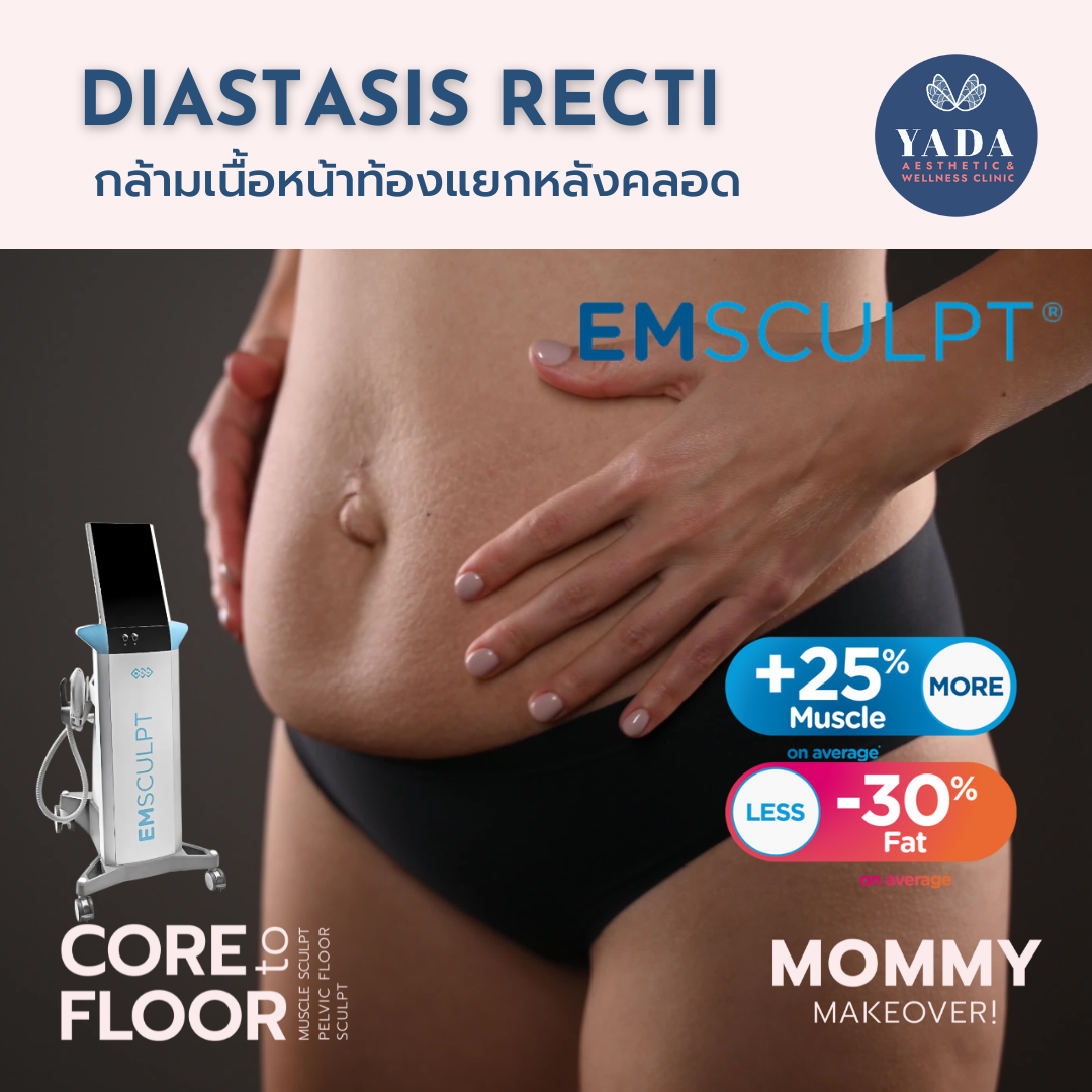 Treat Mommy Tummy with Emsculpt @ Yada Clinic Pattaya